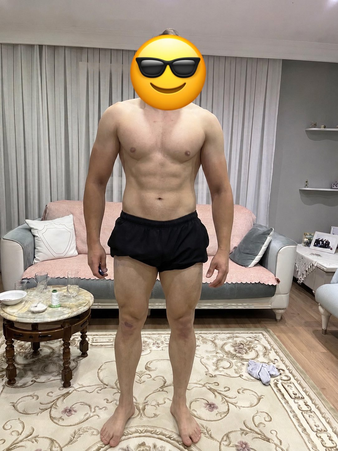 Barış K. — sonra 1